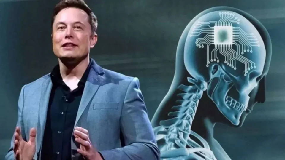 Chip cerebral da Neuralink, do empresário Elon Musk, é aprovado para testes; conheça