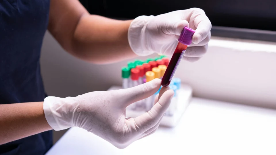 Doença da Vaca Louca: Idoso é internado com suspeita da infecção rara no Brasil