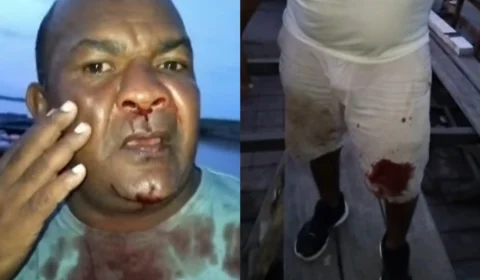 Homem é atacado e agredido com coronhadas por piratas de rio no Amazonas