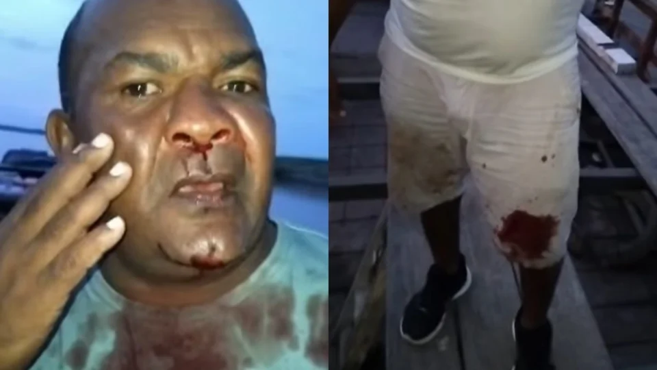 Homem é atacado e agredido com coronhadas por piratas de rio no Amazonas