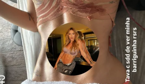 Virgínia mostra resultado da barriga após retirar hérnia umbilical; veja