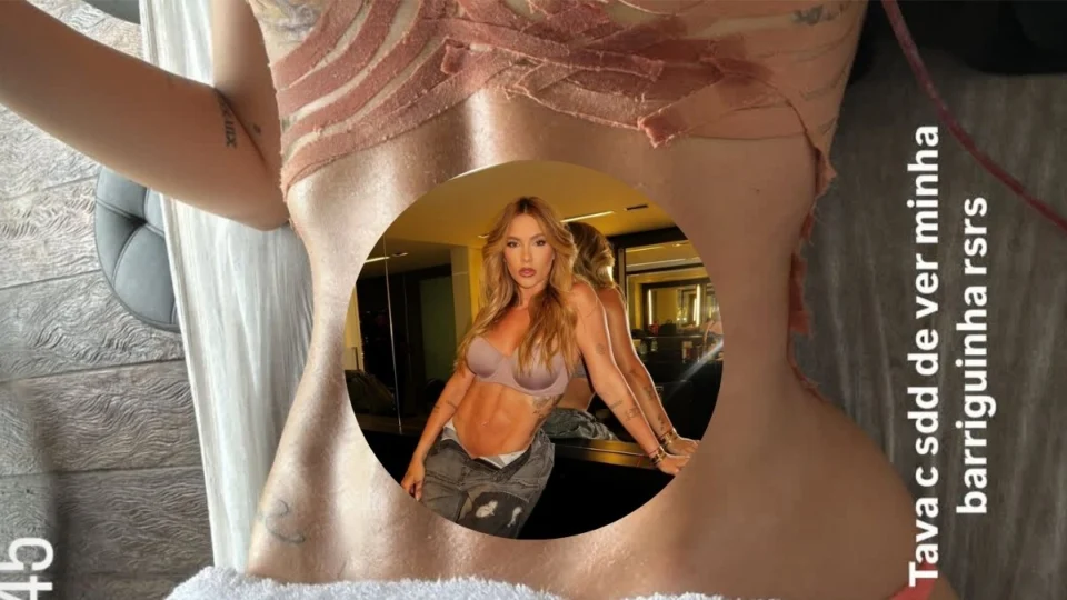 Virgínia mostra resultado da barriga após retirar hérnia umbilical; veja