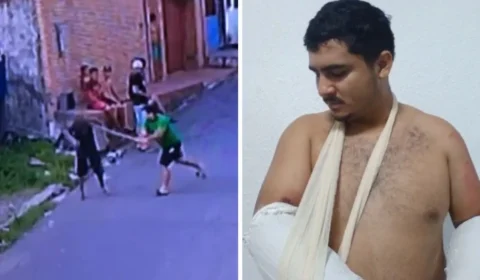‘Lição’: Homem agride morador em situação de rua e tem braços quebrados por facção em Manaus; veja vídeo