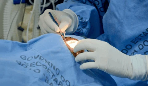 Ao todo, Tocantins já realizou 416 transplantes de córneas