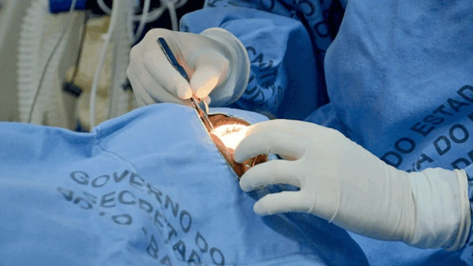 Ao todo, Tocantins já realizou 416 transplantes de córneas