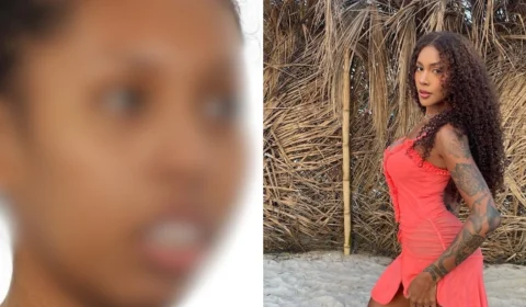 Cirurgia ortognática: ‘antes e depois’ de Giovanna do BBB 25 dispara interesse no Brasil