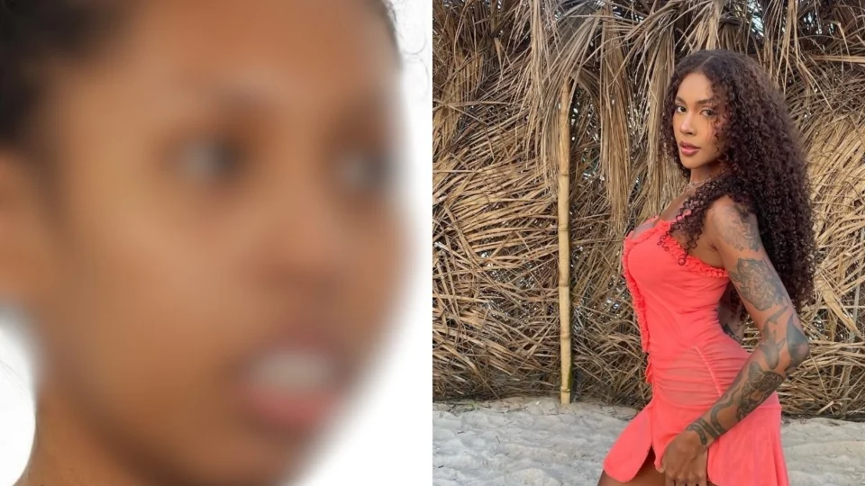 Cirurgia ortognática: ‘antes e depois’ de Giovanna do BBB 25 dispara interesse no Brasil