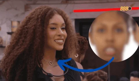 Cirurgia ortognática: antes e depois de Giovana do BBB; “mudou minha vida”