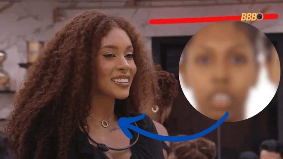 Cirurgia ortognática: antes e depois de Giovana do BBB; “mudou minha vida”