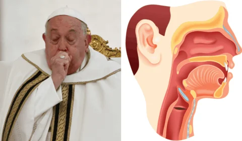 O que é Broncoaspiração, condição que acometeu o papa Francisco? Entenda se você corre risco