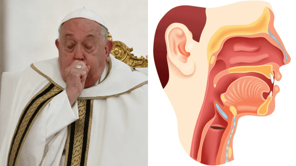 O que é Broncoaspiração, condição que acometeu o papa Francisco? Entenda se você corre risco