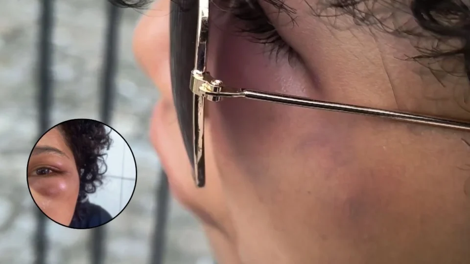 EXCLUSIVO: adolescente foge de cárcere privado após ser espancada junto com filho de 1 ano em Manaus