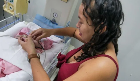 Gêmeas siamesas nascidas em Manaus vão passar por cirurgia de separação em hospital de Goiás