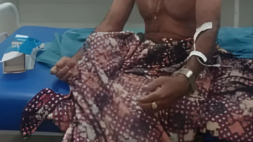 Idoso de 72 anos é esfaqueado durante assalto e suspeitos são presos em Maraã; veja vídeo