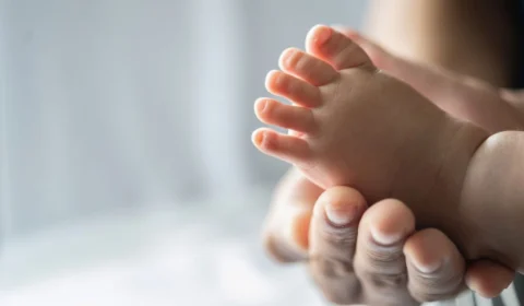 Minoxidil pode causar síndrome do lobisomem em bebês; alerta Anvisa