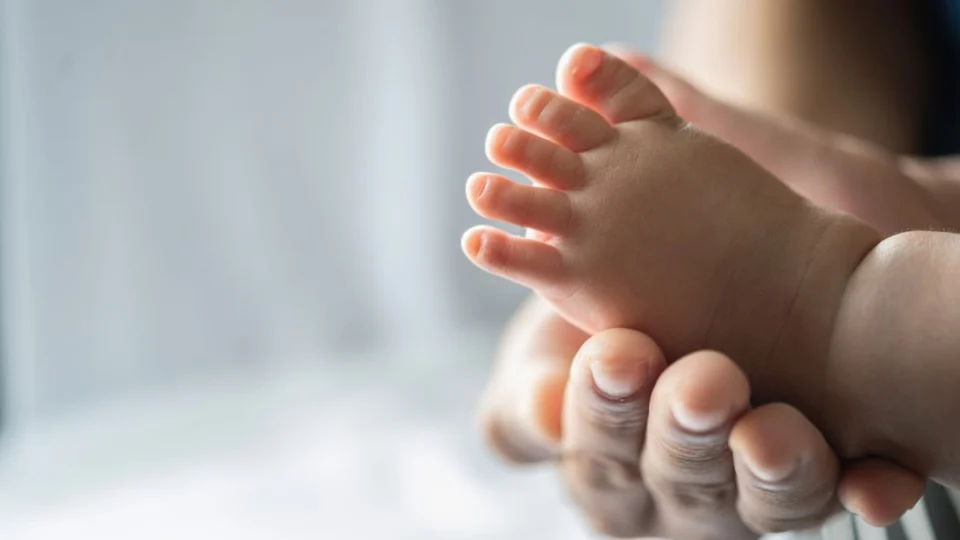 Minoxidil pode causar síndrome do lobisomem em bebês; alerta Anvisa