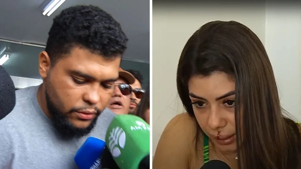 Vítima de cantor faz vaquinha para cirurgia dentária após agressão em Manaus