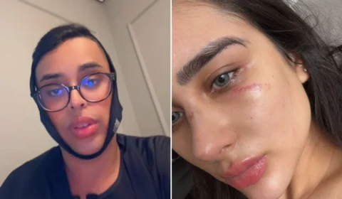 Amigo do ex rebate Miss Amazonas e faz acusação polêmica: ‘Esfaqueou ele’