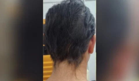 Mãe é suspeita de espancar filha com cabo de vassoura e cortar cabelo dela com faca em Manaus