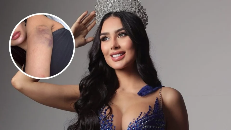Miss Amazonas, Mariana Barroso, denuncia ex-namorado por agressões e ameaça