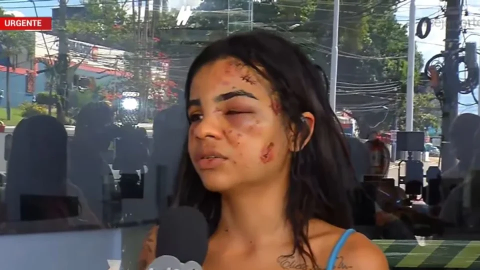 Jovem de 20 anos é espancada após recusar relação com homem após festa em Manaus