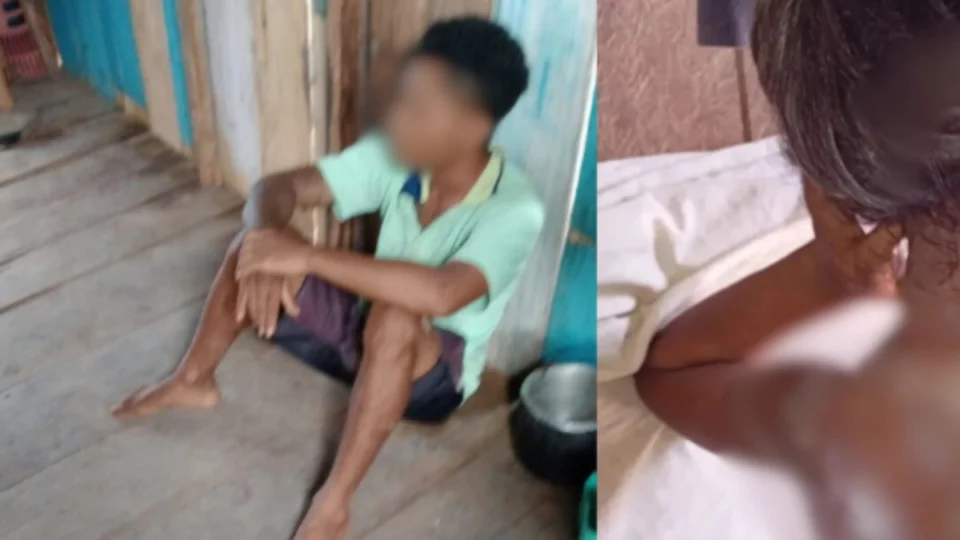 Padrasto é preso sob a suspeita de ter jogado mingau quente contra criança no Amazonas