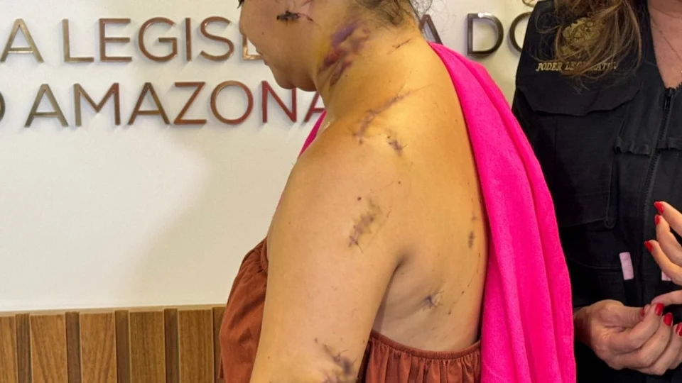 Mulher mostra cortes após ataque do ex em Manaus; filha de 10 meses foi atingida na coxa