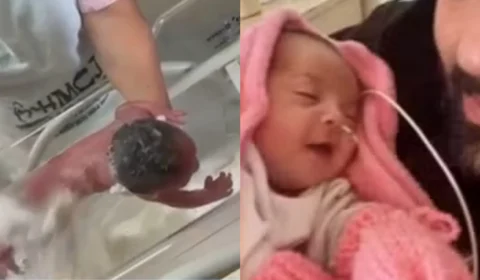 Bebê que sofreu queimaduras durante banho em maternidade do Acre apresenta melhora em hospital de MG