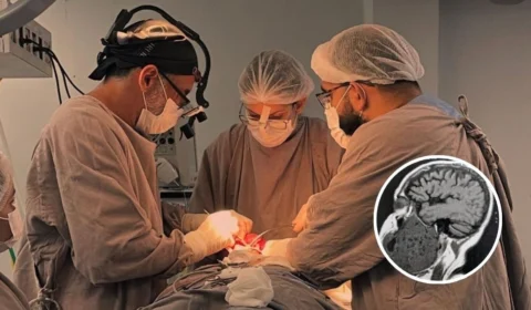 Paciente com deformidade facial causada por tumor gigante na mandíbula passa por cirurgia inédita em Manaus