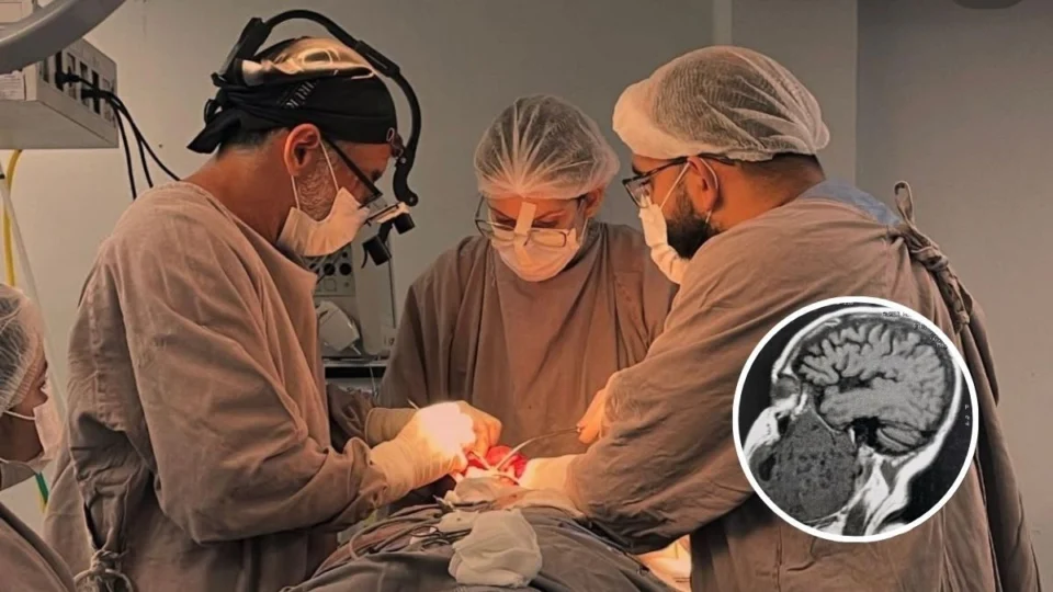 Paciente com deformidade facial causada por tumor gigante na mandíbula passa por cirurgia inédita em Manaus