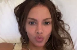 Novo rosto de Anitta: cantora já fez mais de 50 procedimentos estéticos