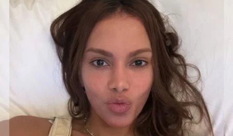 Novo rosto de Anitta: cantora já fez mais de 50 procedimentos estéticos