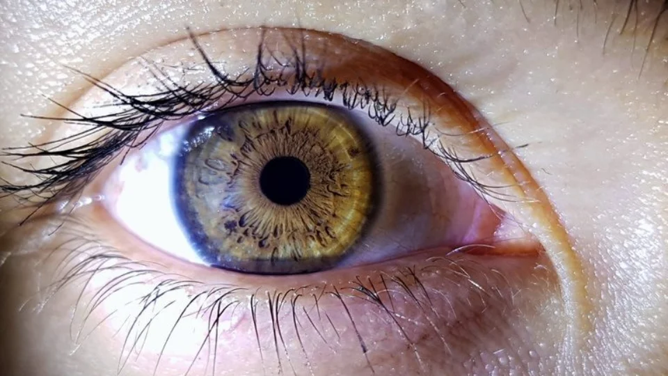 Acre tem fila de espera de mais de 1000 dias para transplante de córnea