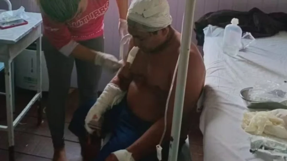 VÍDEO: Onça ataca cacique no Amazonas e o deixa com ferimentos graves na cabeça; confira