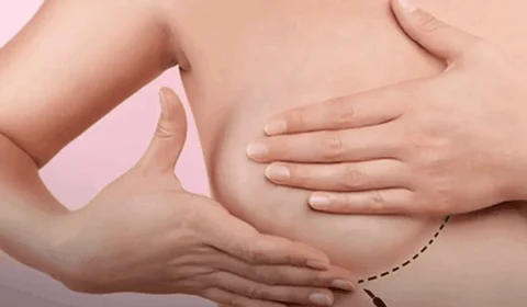 Ministério da Saúde amplia acesso à mamografia para mulheres a partir dos 40 anos