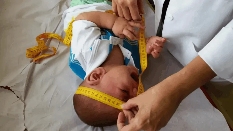 Indenização de R$ 50 mil e pensão vitalícia começam a ser pagas a famílias afetadas pelo Zika