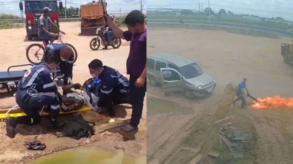 VÍDEO: Motociclista sofre queimaduras graves após colisão com caçamba