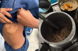 Irmãos de 7 e 8 anos são resgatados em Roraima após denúncia de maus-tratos