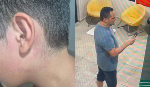 Menino de 8 anos em Manaus pode perder a audição após ter tímpano perfurado por servidor do TJAM
