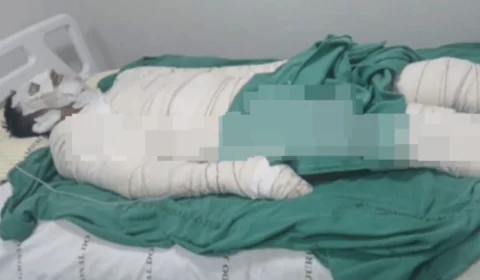 Trabalhador sofre graves queimaduras em incêndio a bordo de embarcação no interior do Acre