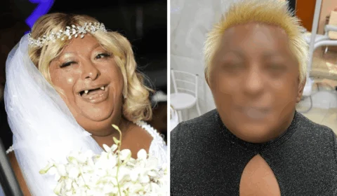 Patixa exibe sorrisão renovado e mostra novo resultado dos dentes; veja fotos