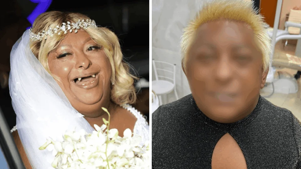 Homem morre após 14 dias internado em Porto Velho após grave acidente