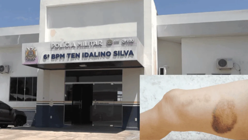 Criança é brutalmente espancada pelo pai alcoolizado no interior do Acre