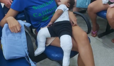 Acre firma convênio para criar banco de órteses e fortalecer tratamento do pé torto congênito