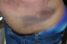 Homem sofre agressões e tem móveis destruídos por familiares no Jardim Santana em Porto Velho