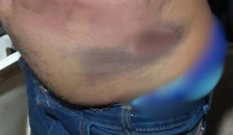 Homem sofre agressões e tem móveis destruídos por familiares no Jardim Santana em Porto Velho