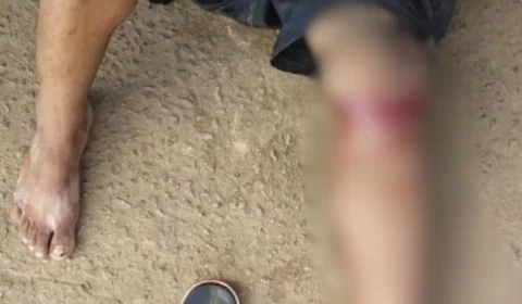 Homem é gravemente ferido com golpes de facão na zona Leste de Porto Velho