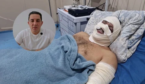 Ex-prefeito de Borba sofre queimaduras após explosão de lancha