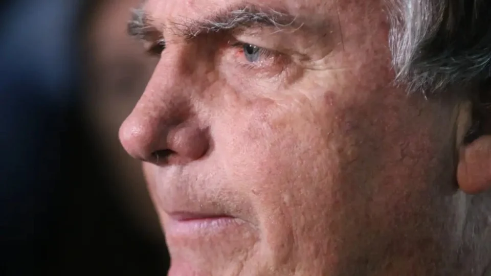 Bolsonaro passa por nova cirurgia após nova crise de soluços, diz hospital