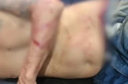 Homem é atacado por pitbull ao invadir residência e acaba preso em Porto Velho